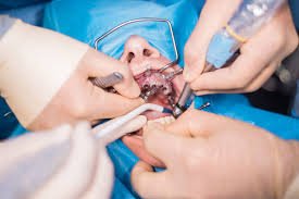 oral surgery