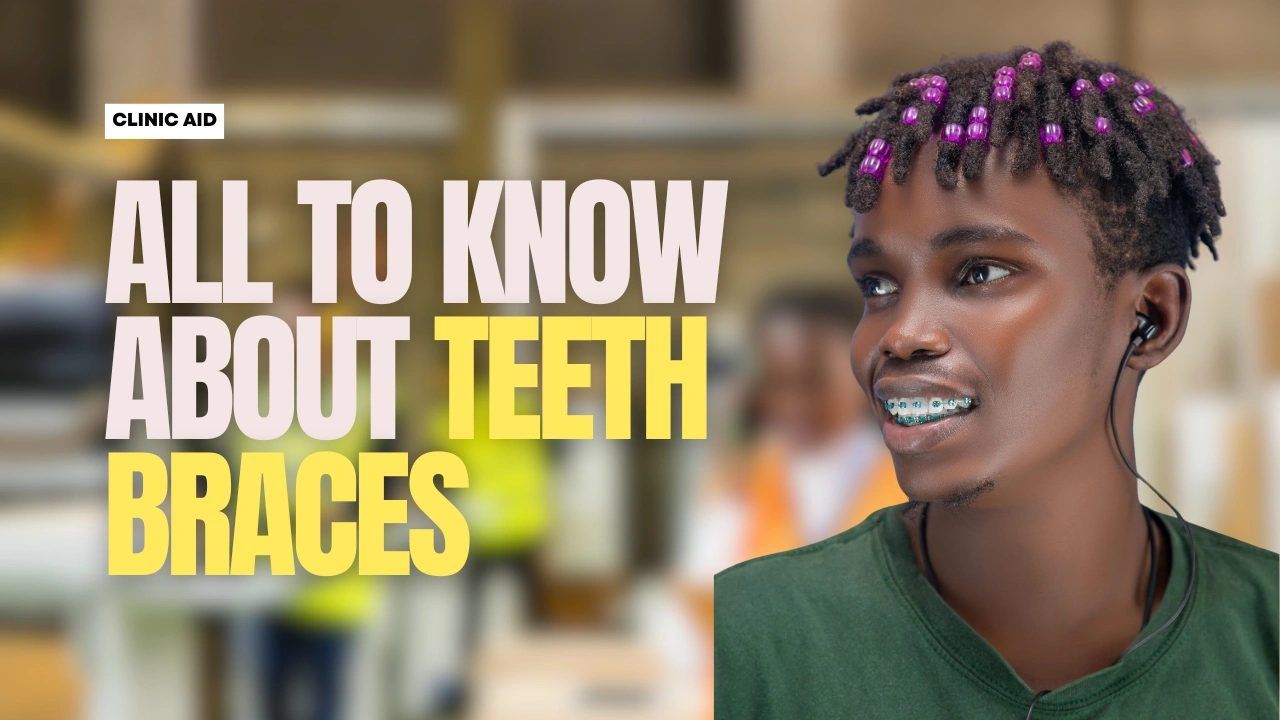 All You Should Know About Teeth Braces in Lagos - Dr. Reach Dental Clinic
