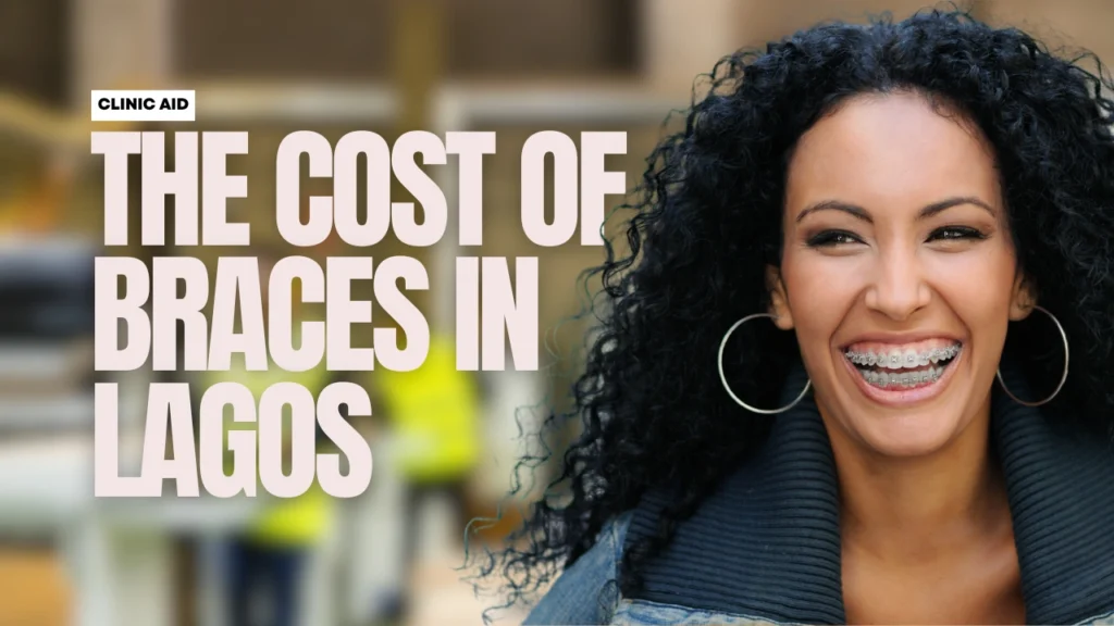 Cost of Braces in Nigeria