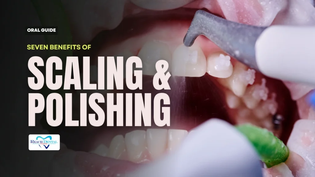 benefits of scaling and polishing teeth