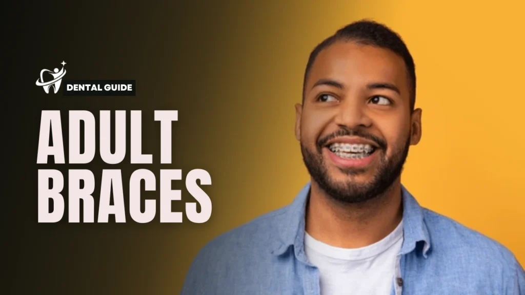 braces in adults