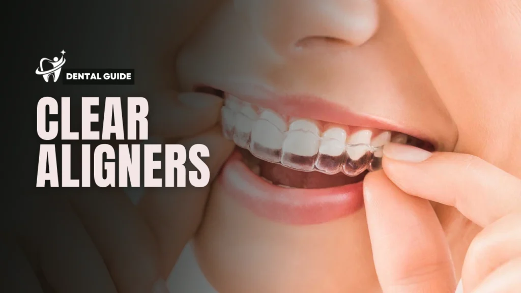 Clear Aligners in Lagos