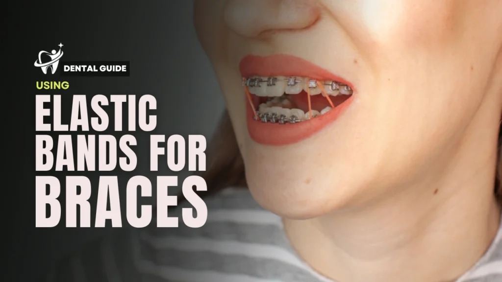 Elastic Band Braces