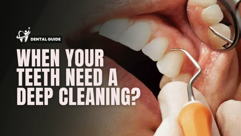 When you need deep cleaning