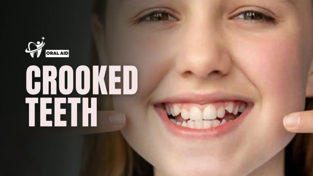 Crooked Teeth