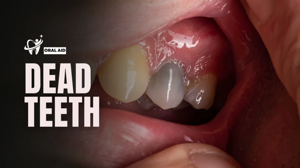 dead teeth